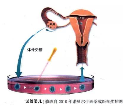 试管婴儿前期检查ct吗（试管婴儿早期补救ICSI是怎么回事）